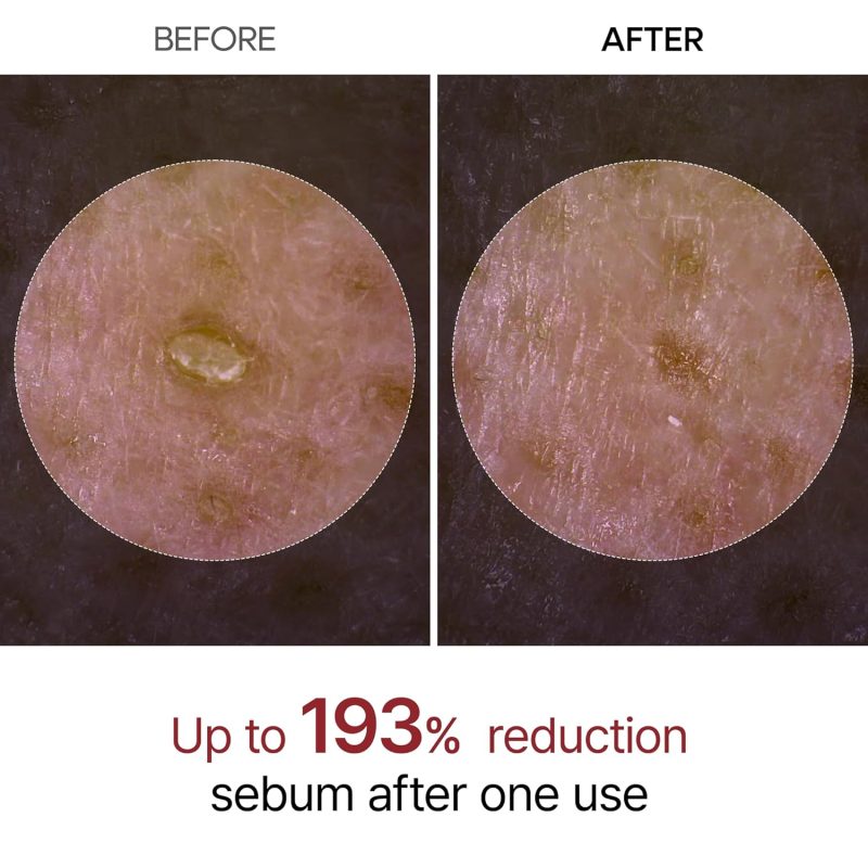 Dr. Melaxin Peel Shot Glow Rice Ampoule (80ml) - Image 9