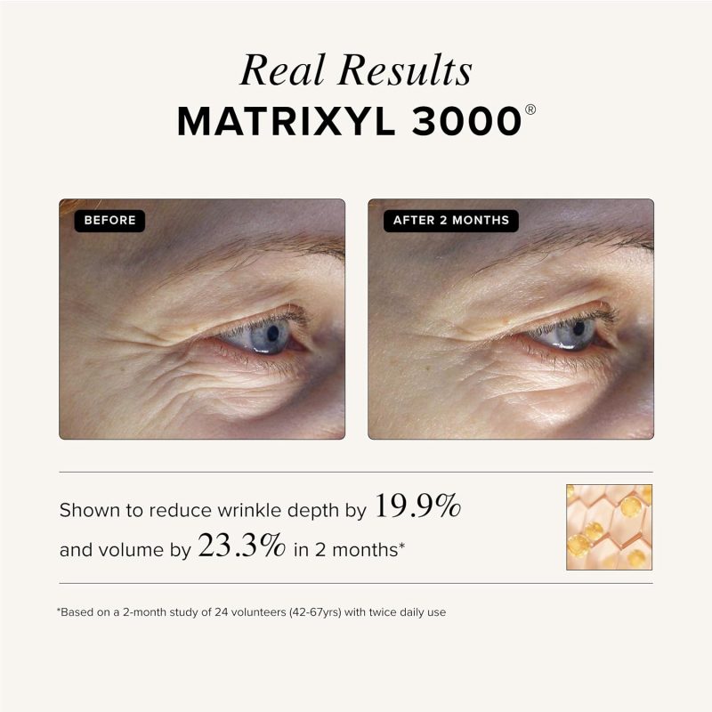 Triple Repair Matrixyl 3000 + Argireline + Hyaluronic Acid + Vitamin C Serum - Image 4